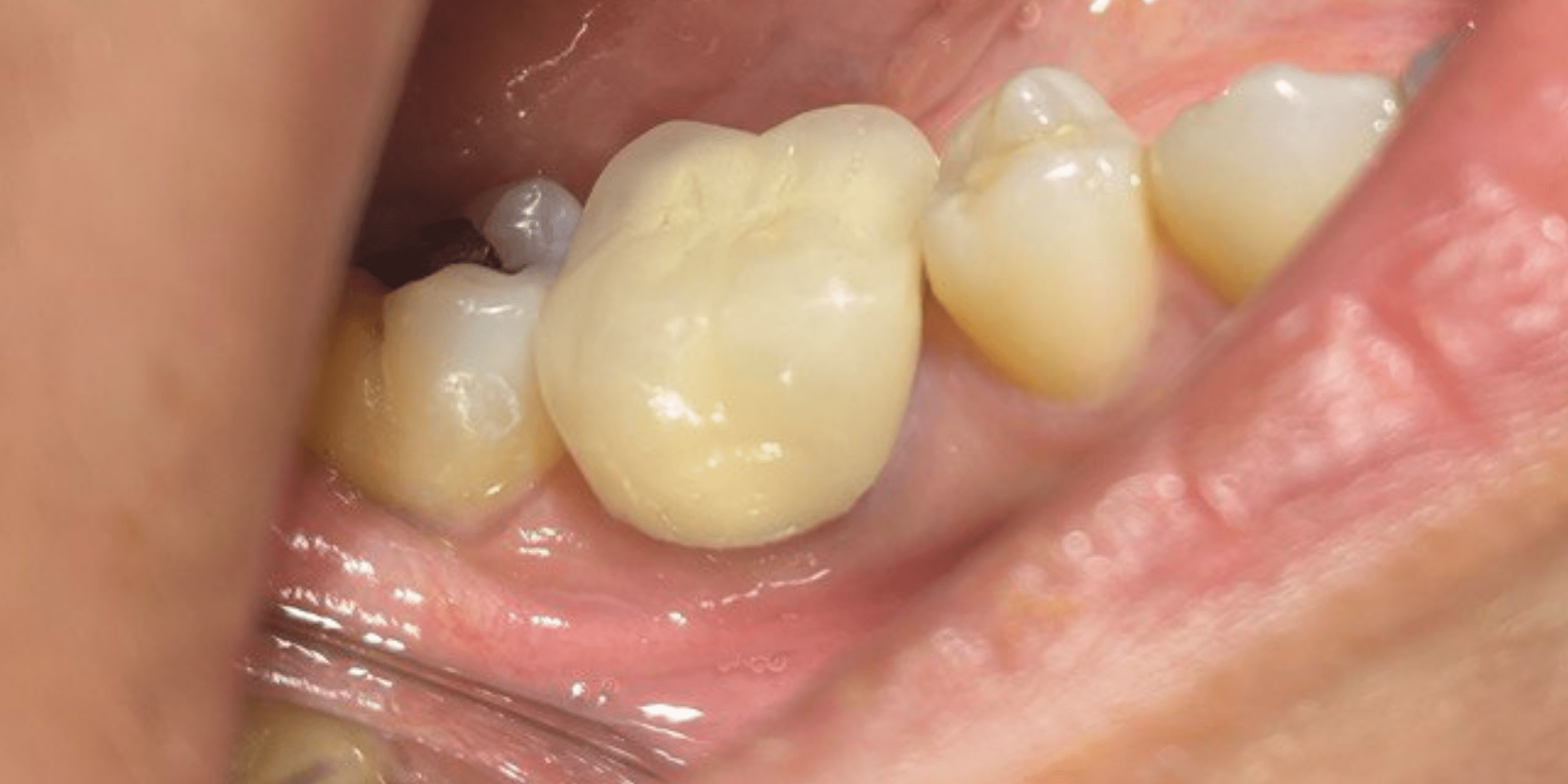 Crown 3 1