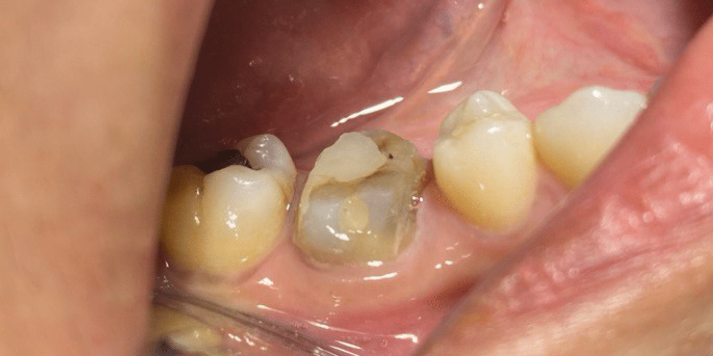 Crown 3