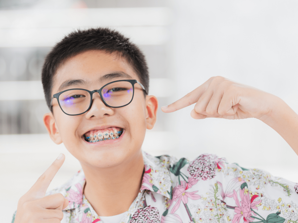 Kapan Anak Boleh Menggunakan Behel Kawat Gigi?