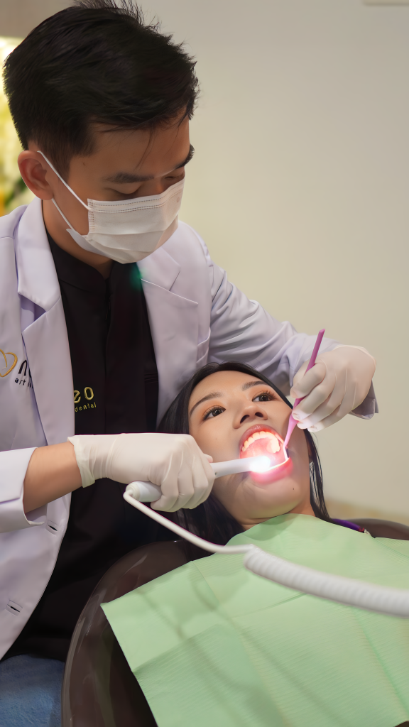 FAQ Veneer Gigi – Neo Art Dental Center